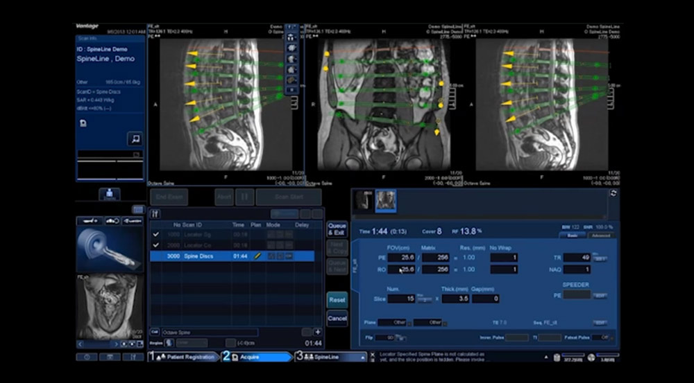 SpineLine + Spine