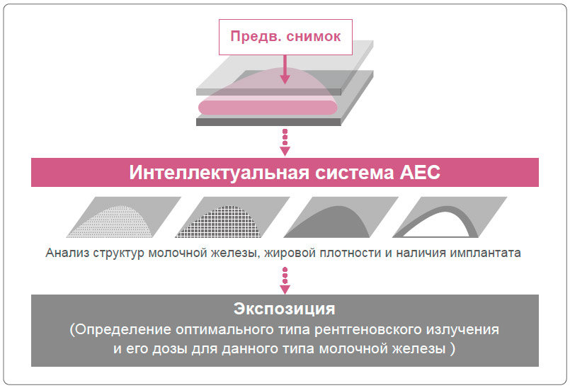 Как работает интеллектуальная система AEC