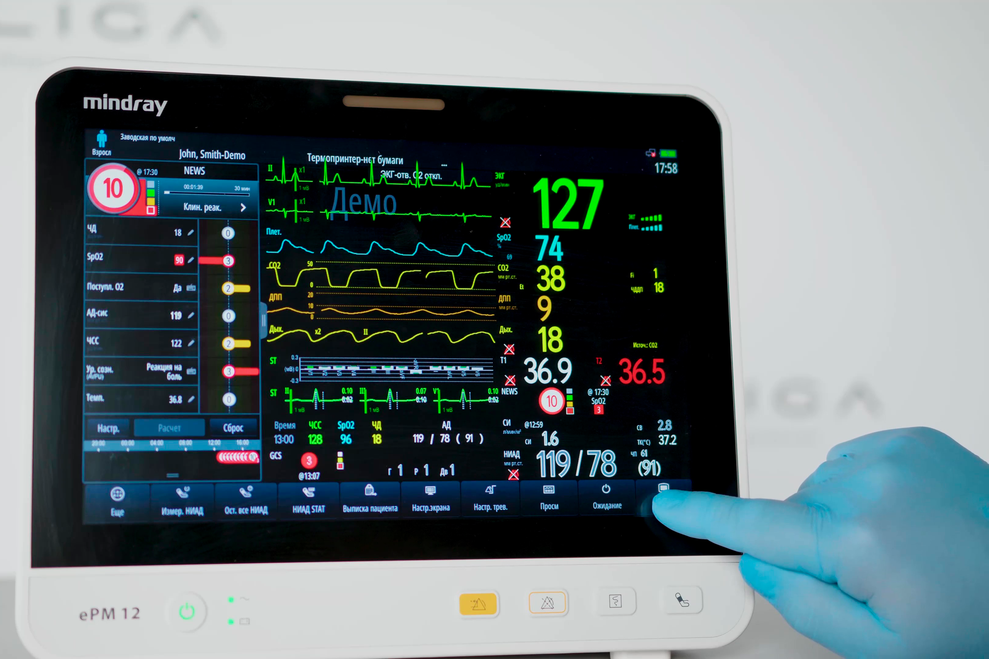 Большой видеообзор мониторов пациента Mindray ePM
