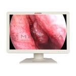 Эндоскопический комплект на базе AOHUA, 6