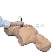 MedVision SonoVision