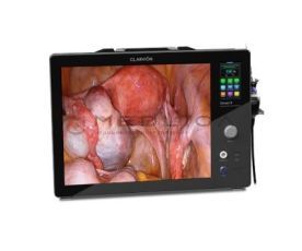 Chammed QVION 19 (Full HD)