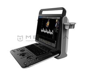 Chison SonoTouch 60 Pro