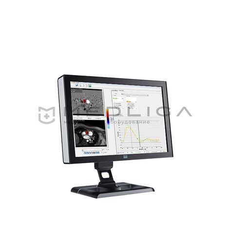 Esaote CAAS MR Flow, 3