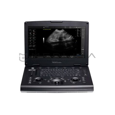 GE Versana Active, 3