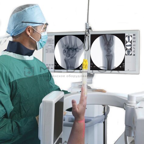 GE OEC Elite MiniView, 3