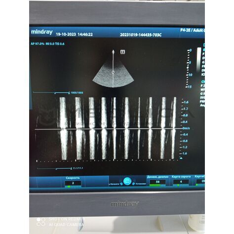 Mindray P4-2E (БУ, 2019), Серийный номер: VSY9B039073, 8